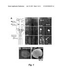 TREATMENT OF SPINAL CORD INJURY OR TRAUMATIC BRAIN INJURY BY INHIBITION OF     AMYLOIDOGENIC PROTEINS AND SYNUCLEIN PROTEIN ACCUMULATION OR AGGREGATION diagram and image