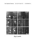 TREATMENT OF SPINAL CORD INJURY OR TRAUMATIC BRAIN INJURY BY INHIBITION OF     AMYLOIDOGENIC PROTEINS AND SYNUCLEIN PROTEIN ACCUMULATION OR AGGREGATION diagram and image