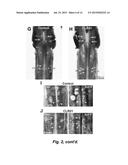 TREATMENT OF SPINAL CORD INJURY OR TRAUMATIC BRAIN INJURY BY INHIBITION OF     AMYLOIDOGENIC PROTEINS AND SYNUCLEIN PROTEIN ACCUMULATION OR AGGREGATION diagram and image