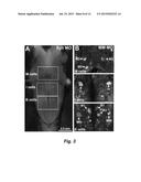 TREATMENT OF SPINAL CORD INJURY OR TRAUMATIC BRAIN INJURY BY INHIBITION OF     AMYLOIDOGENIC PROTEINS AND SYNUCLEIN PROTEIN ACCUMULATION OR AGGREGATION diagram and image