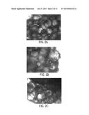 Injectable Brown Adipose Microtissues for Treatment and Prevention of     Obesity and Diabetes diagram and image