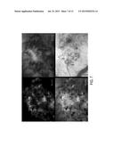 Injectable Brown Adipose Microtissues for Treatment and Prevention of     Obesity and Diabetes diagram and image