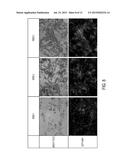 Injectable Brown Adipose Microtissues for Treatment and Prevention of     Obesity and Diabetes diagram and image