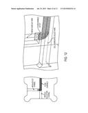 Injectable Brown Adipose Microtissues for Treatment and Prevention of     Obesity and Diabetes diagram and image