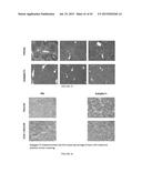 ENDOGLIN PEPTIDES TO TREAT FIBROTIC DISEASES diagram and image