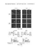 METHODS AND COMPOSITIONS FOR TREATING ANTIPROGESTIN-RESISTANT CANCERS diagram and image