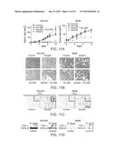 METHODS AND COMPOSITIONS FOR TREATING ANTIPROGESTIN-RESISTANT CANCERS diagram and image