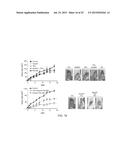 METHODS AND COMPOSITIONS FOR TREATING ANTIPROGESTIN-RESISTANT CANCERS diagram and image