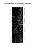 COMBINATION THERAPY FOR THE TREATMENT OF OCULAR NEOVASCULAR DISORDERS diagram and image