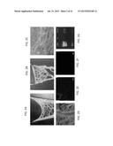 OMENTUM BASED SCAFFOLD AND DELIVERY SYSTEM diagram and image