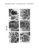 OMENTUM BASED SCAFFOLD AND DELIVERY SYSTEM diagram and image