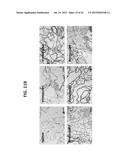 OMENTUM BASED SCAFFOLD AND DELIVERY SYSTEM diagram and image