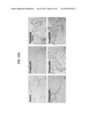 OMENTUM BASED SCAFFOLD AND DELIVERY SYSTEM diagram and image