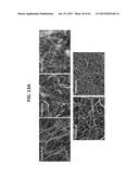 OMENTUM BASED SCAFFOLD AND DELIVERY SYSTEM diagram and image