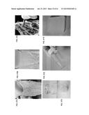 OMENTUM BASED SCAFFOLD AND DELIVERY SYSTEM diagram and image