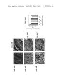 OMENTUM BASED SCAFFOLD AND DELIVERY SYSTEM diagram and image