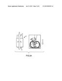 CPR VOLUME EXCHANGER VALVE SYSTEM WITH SAFETY FEATURE AND METHODS diagram and image