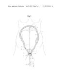 Adjustable Vaginal Anchor for Uterine Tamponade Device and Methods of     Using The Same diagram and image