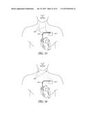 SELECTIVE NERVE STIMULATION USING PRESYNAPTIC TERMINAL DEPLETION BLOCK diagram and image