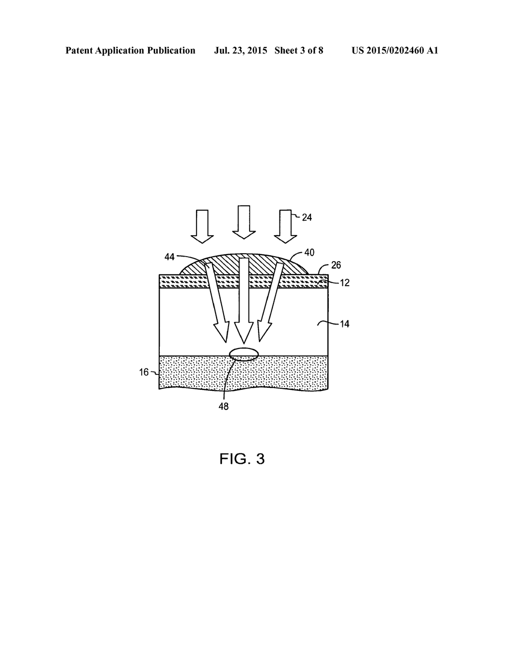 Apparatus for Treating Cellulite - diagram, schematic, and image 04