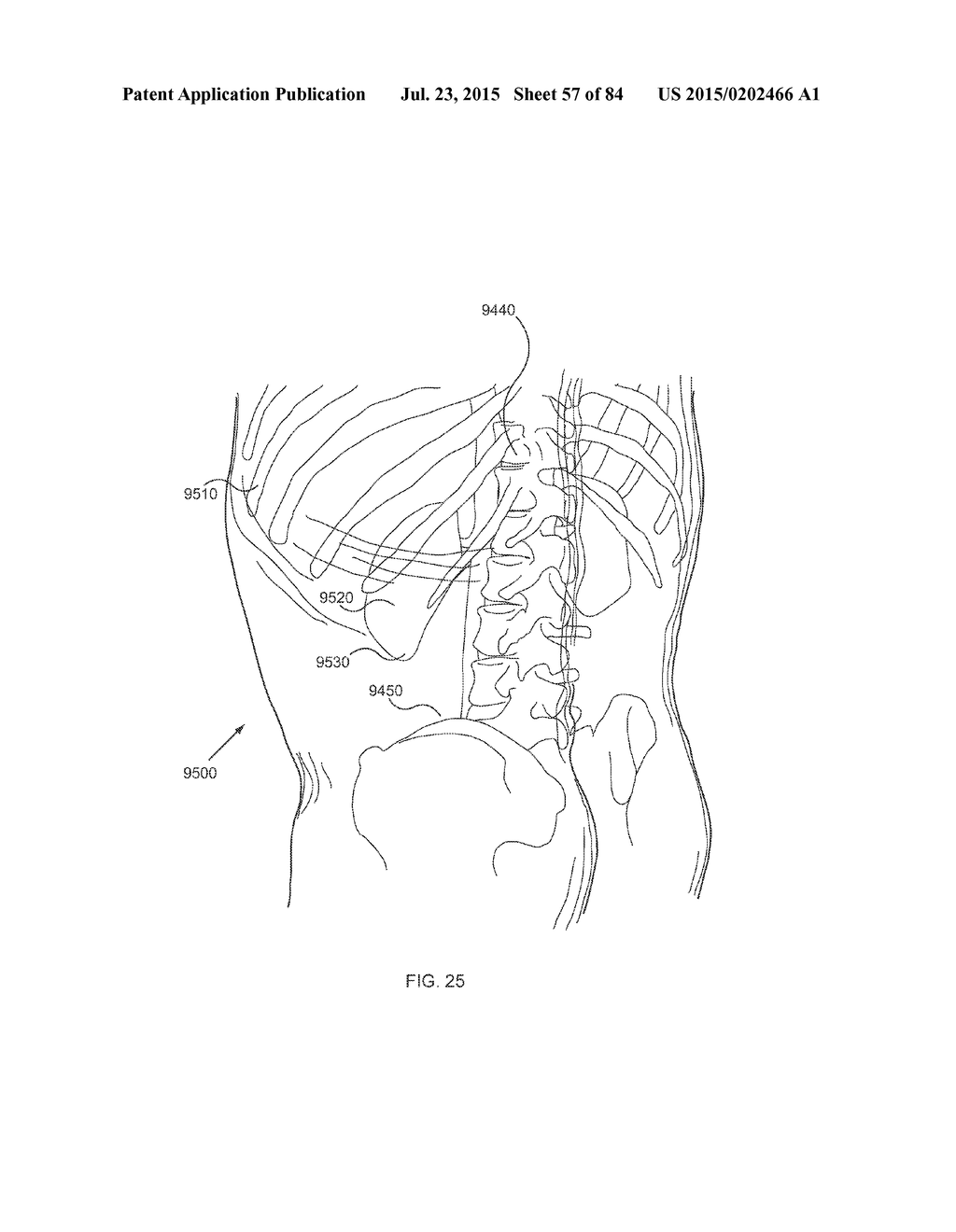 ENERGETIC MODULATION OF NERVES - diagram, schematic, and image 58