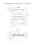 CUSHIONING SLIDES diagram and image