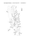 Spring Back Safety and Film Cutter diagram and image