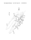 Spring Back Safety and Film Cutter diagram and image