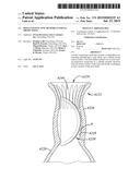 BOTTLE HAVING ONE OR MORE INTERNAL PROJECTIONS diagram and image