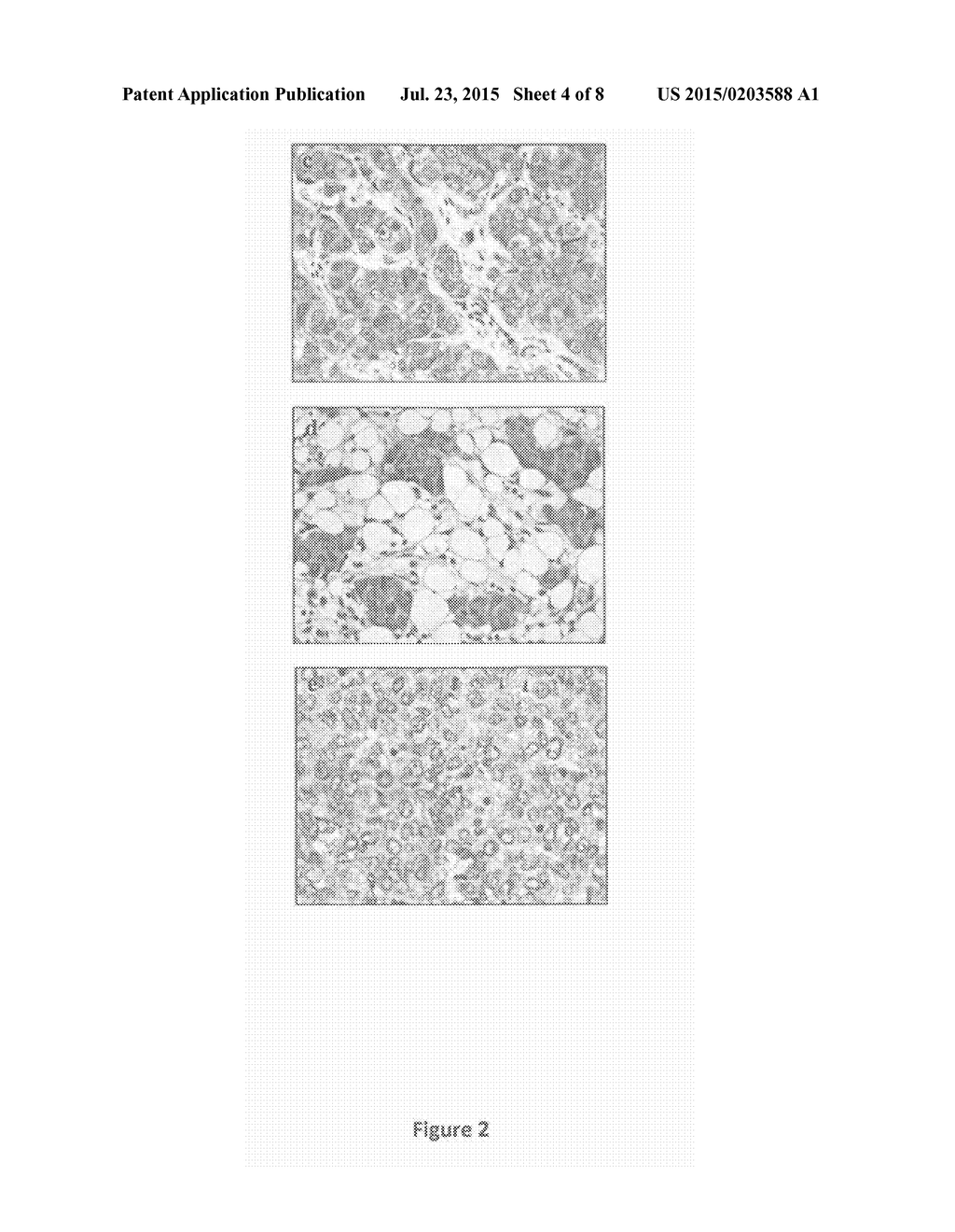 Cancer Biomarkers and Methods of Use Thereof - diagram, schematic, and image 05