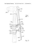 METHOD OF REPAIRING A WIND TURBINE BLADE diagram and image