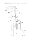 METHOD OF REPAIRING A WIND TURBINE BLADE diagram and image