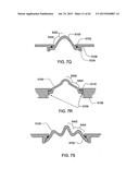 SENSOR APPARATUS SYSTEMS, DEVICES AND METHODS diagram and image