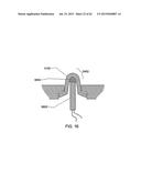 SENSOR APPARATUS SYSTEMS, DEVICES AND METHODS diagram and image