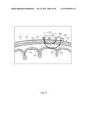 SYSTEMS AND METHODS FOR MONITORING CLINICAL PROCEDURES USING REGIONAL     BLOOD OXYGEN SATURATION diagram and image