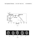 METHOD AND APPARATUS FOR EXTRACTION AND QUANTIFICATION OF HEMATOMA FROM A     BRAIN SCAN SUCH AS COMPUTED TOMOGRAPHY DATA diagram and image