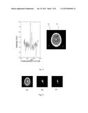 METHOD AND APPARATUS FOR EXTRACTION AND QUANTIFICATION OF HEMATOMA FROM A     BRAIN SCAN SUCH AS COMPUTED TOMOGRAPHY DATA diagram and image