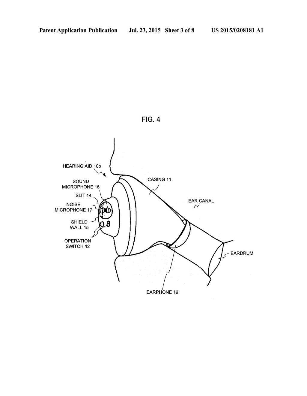 RUBBING SOUND PREVENTION HEARING AID - diagram, schematic, and image 04