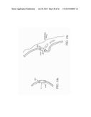 METHODS OF PROCESSING DATA OBTAINED FROM MEDICAL DEVICE diagram and image