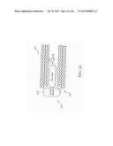 METHODS OF PROCESSING DATA OBTAINED FROM MEDICAL DEVICE diagram and image