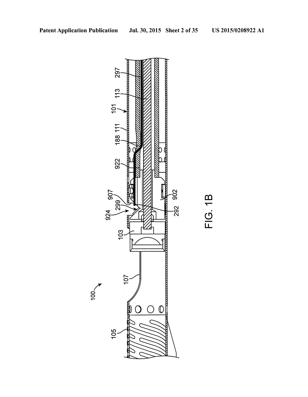 BALLOON ATHERECTOMY CATHETERS WITH IMAGING - diagram, schematic, and image 03