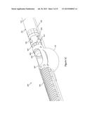 BALLOON ATHERECTOMY CATHETERS WITH IMAGING diagram and image