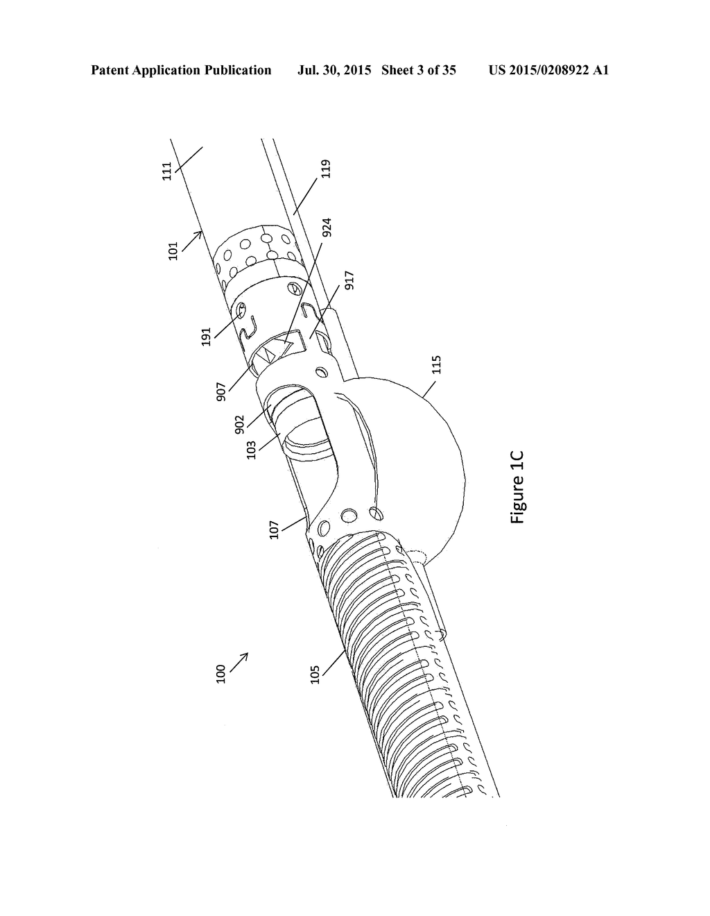 BALLOON ATHERECTOMY CATHETERS WITH IMAGING - diagram, schematic, and image 04