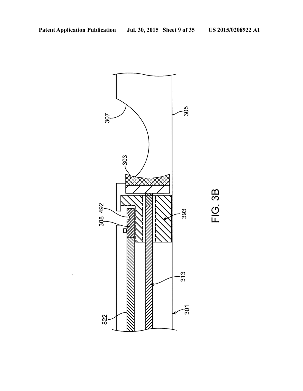 BALLOON ATHERECTOMY CATHETERS WITH IMAGING - diagram, schematic, and image 10