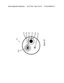 BALLOON ATHERECTOMY CATHETERS WITH IMAGING diagram and image