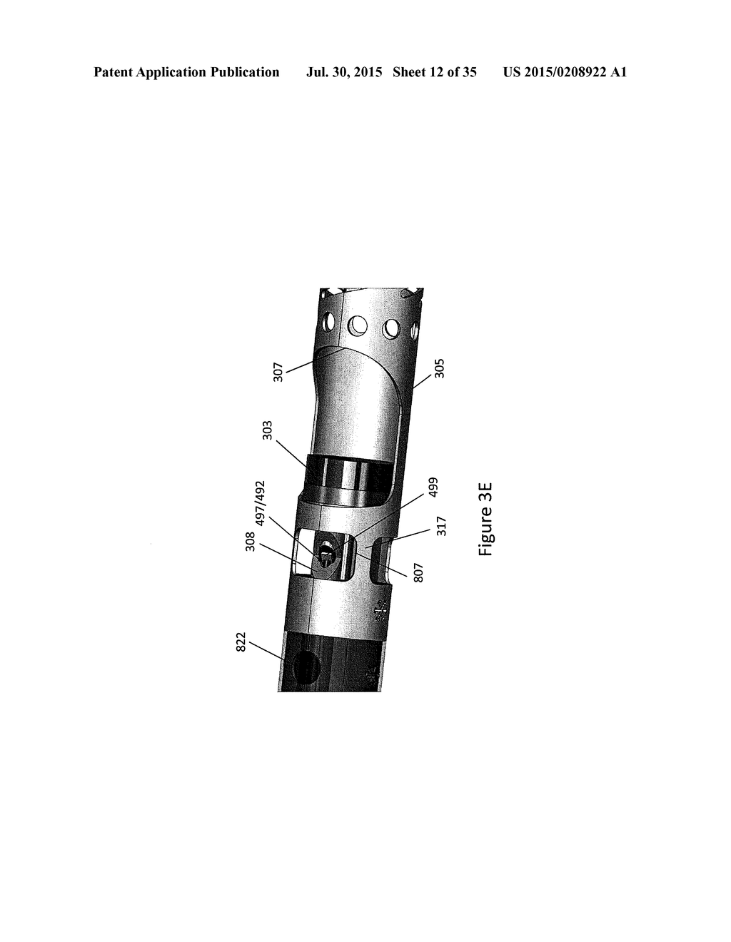 BALLOON ATHERECTOMY CATHETERS WITH IMAGING - diagram, schematic, and image 13