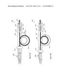 BALLOON ATHERECTOMY CATHETERS WITH IMAGING diagram and image