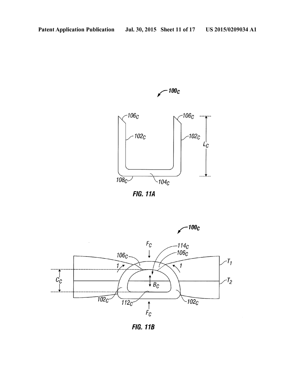 VARYING TISSUE COMPRESSION WITH AN ANVIL CONFIGURATION - diagram, schematic, and image 12