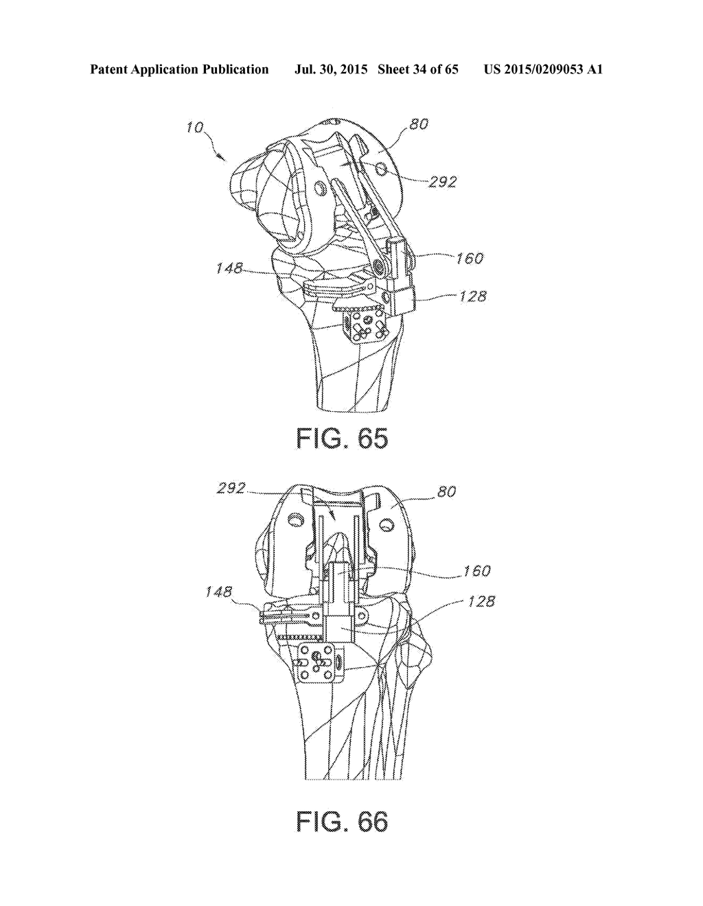 METHODS AND APPARATUS FOR PERFORMING KNEE ARTHROPLASTY - diagram, schematic, and image 35