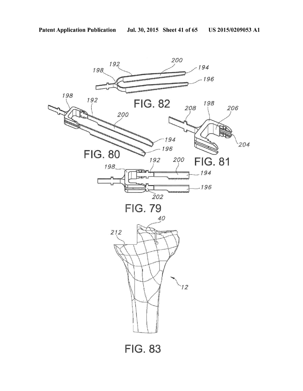 METHODS AND APPARATUS FOR PERFORMING KNEE ARTHROPLASTY - diagram, schematic, and image 42